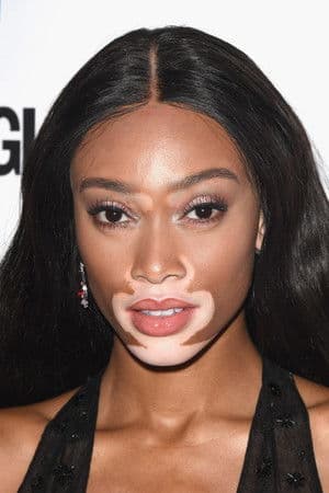 Image of Winnie Harlow